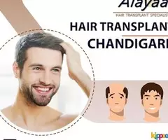 Alayaa Best Hair Transplant Clinic in Chandigarh Cost, Techniques And Benefits