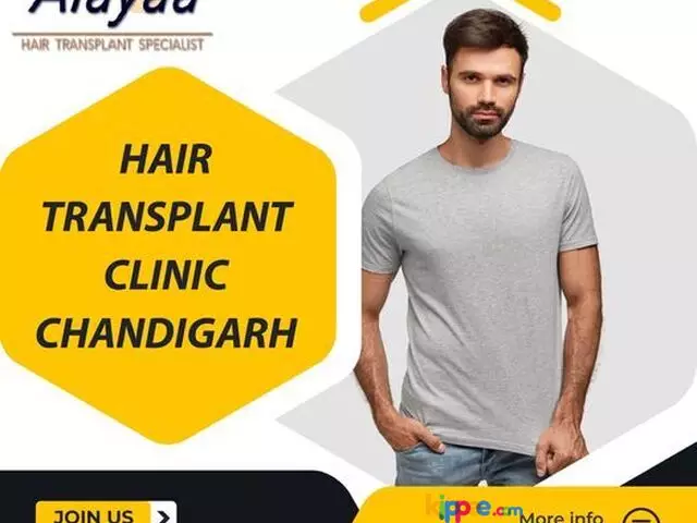 Hair Transplant Clinic in Chandigarh - 1