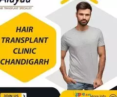Hair Transplant Clinic in Chandigarh