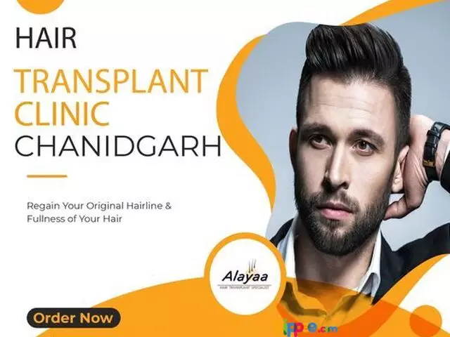 Fue Hair Transplant Specialist in Chandigarh - 1